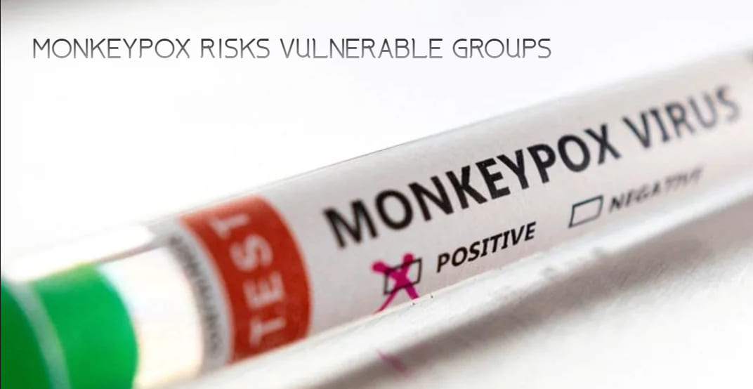 Monkeypox Risk Group Sustained transmission of monkeypox risks vulnerable groups